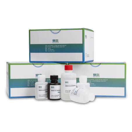 https://www.thalysbio.com.cn/wp-content/uploads/2023/12/15.自免试剂盒-453x453.png